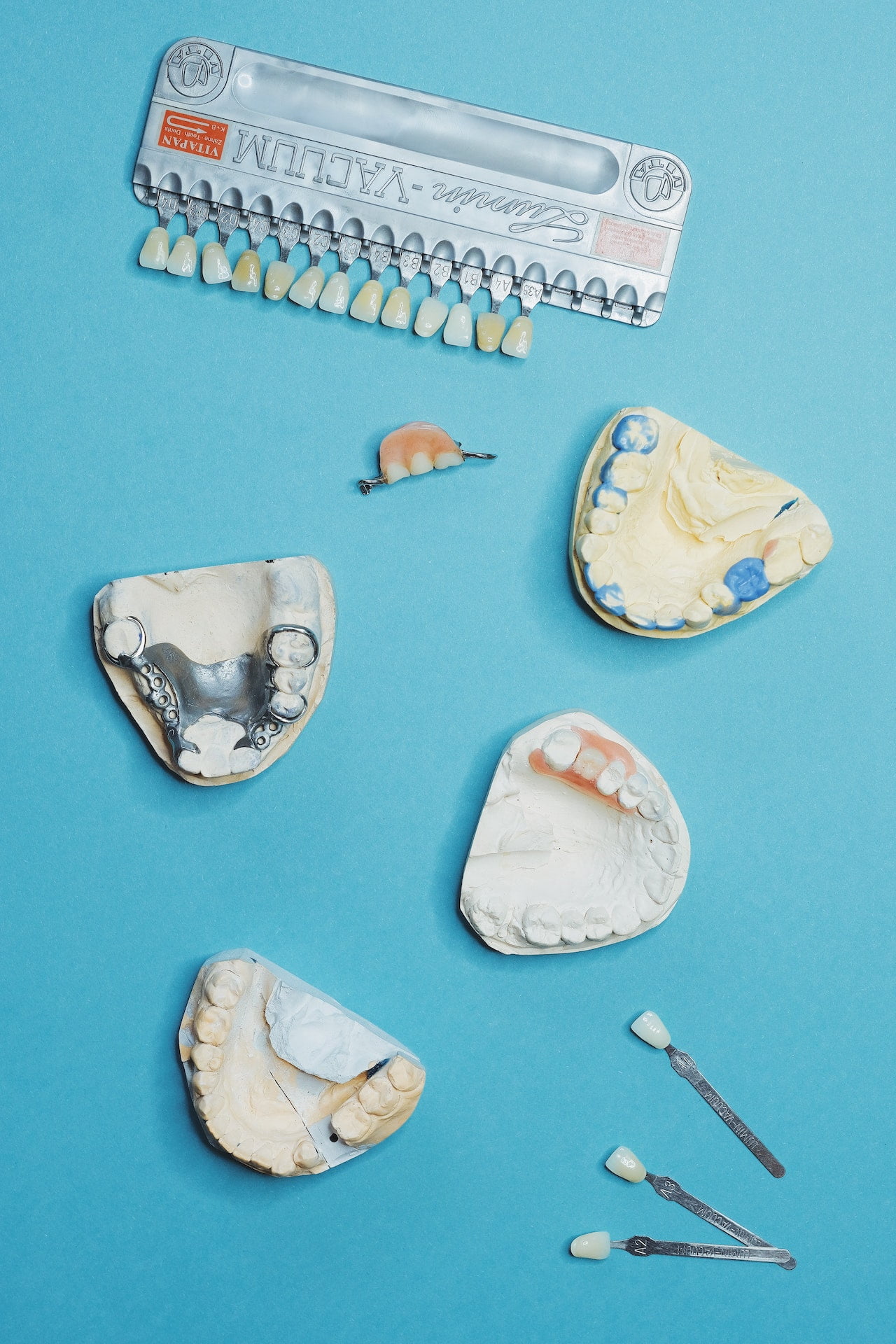 Ce sunt fatetele dentare si de ce sunt necesare?